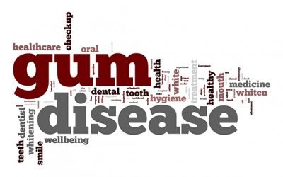 Treating Gum Disease In Our Office And In Your Home