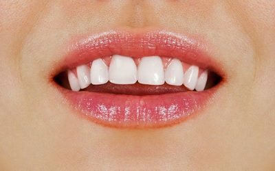 6 Tips For Healthy White Teeth From Your DentArana Dentist