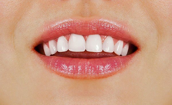 6 Tips For Healthy White Teeth From Your DentArana Dentist